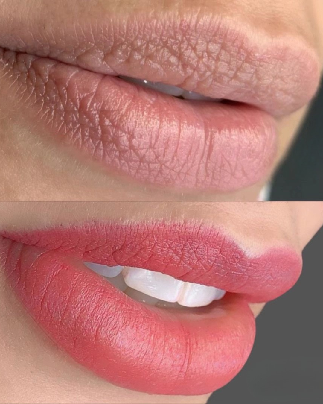 Comparativa de labios, caso 2